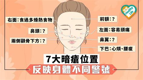 大暗瘡|【暗瘡位置】不同代表什麼？中醫教如何處理及預防